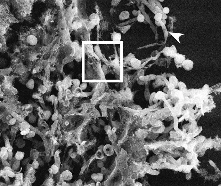 Machine learning helps scientists measure important inflammation process
