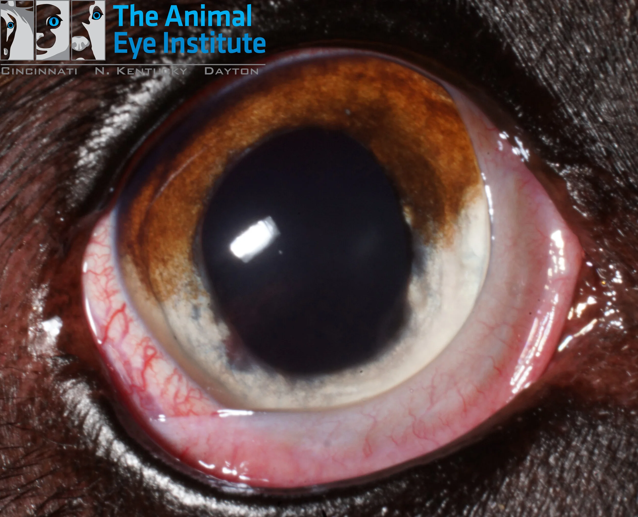 Uveitis