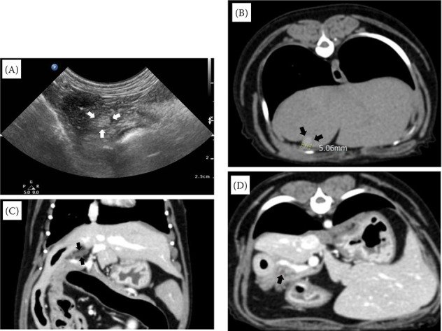 Gallbladder Atrophy in Dogs Linked to Pancreatitis: A Case Study with Imaging Insights