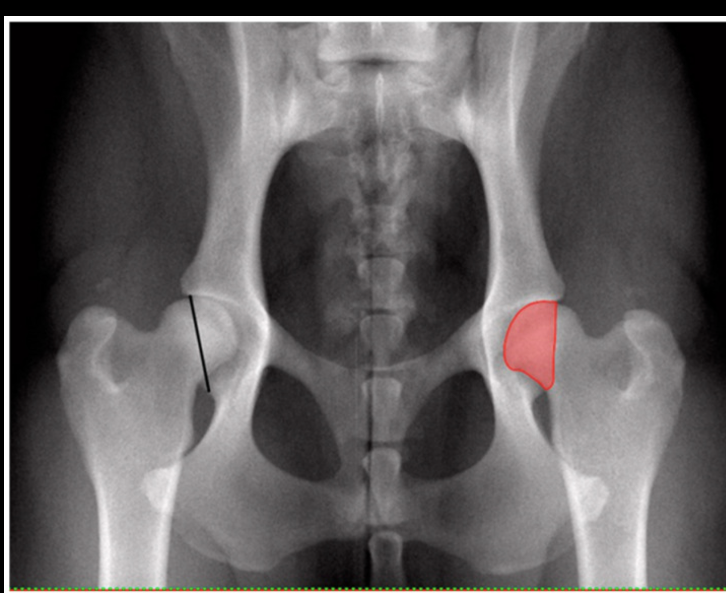 Investigating Radiographic Parameters for Canine Hip Dysplasia: A Breed-Specific Study