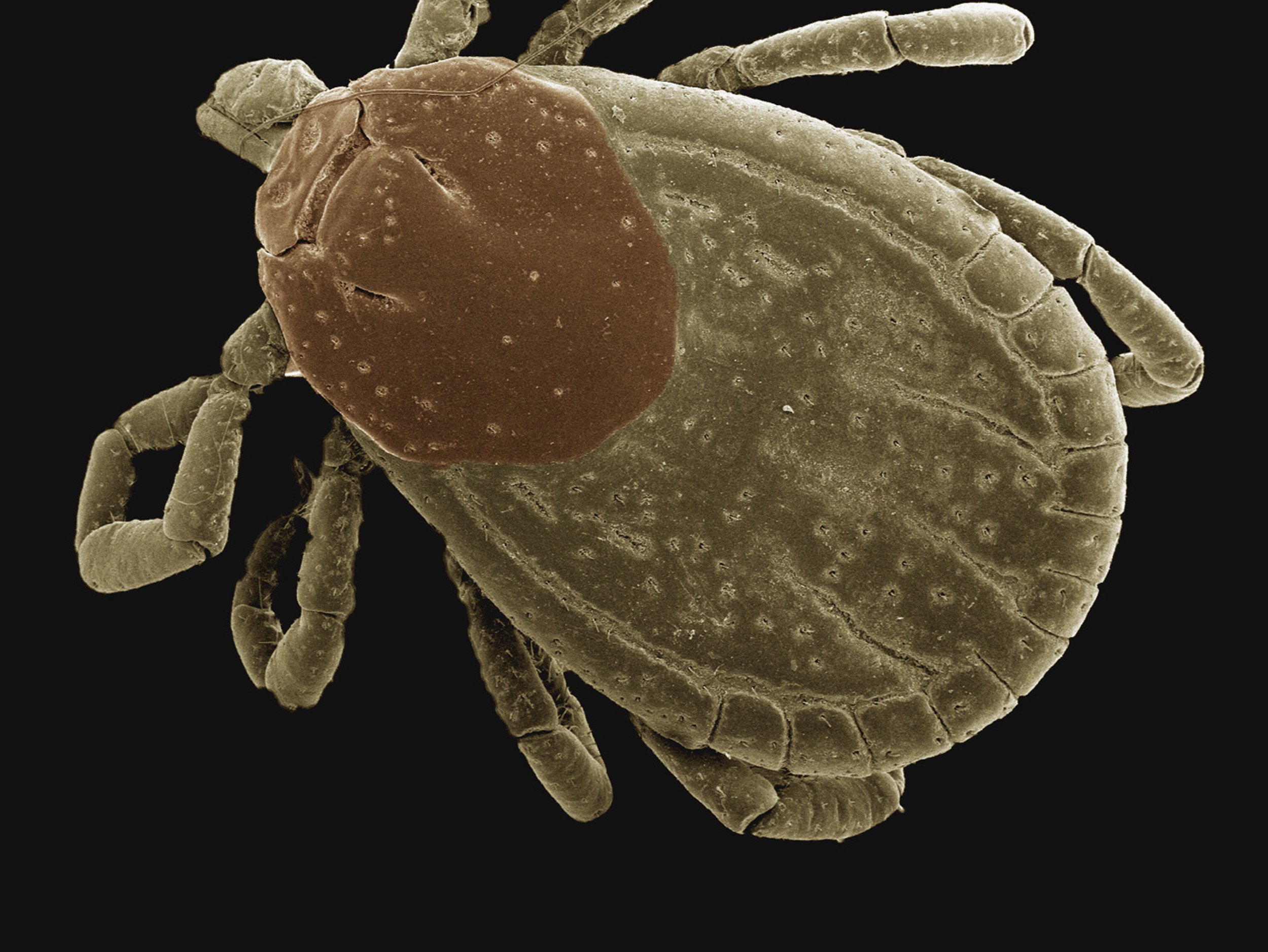 Structure of tick-borne virus revealed at atomic resolution for the first time