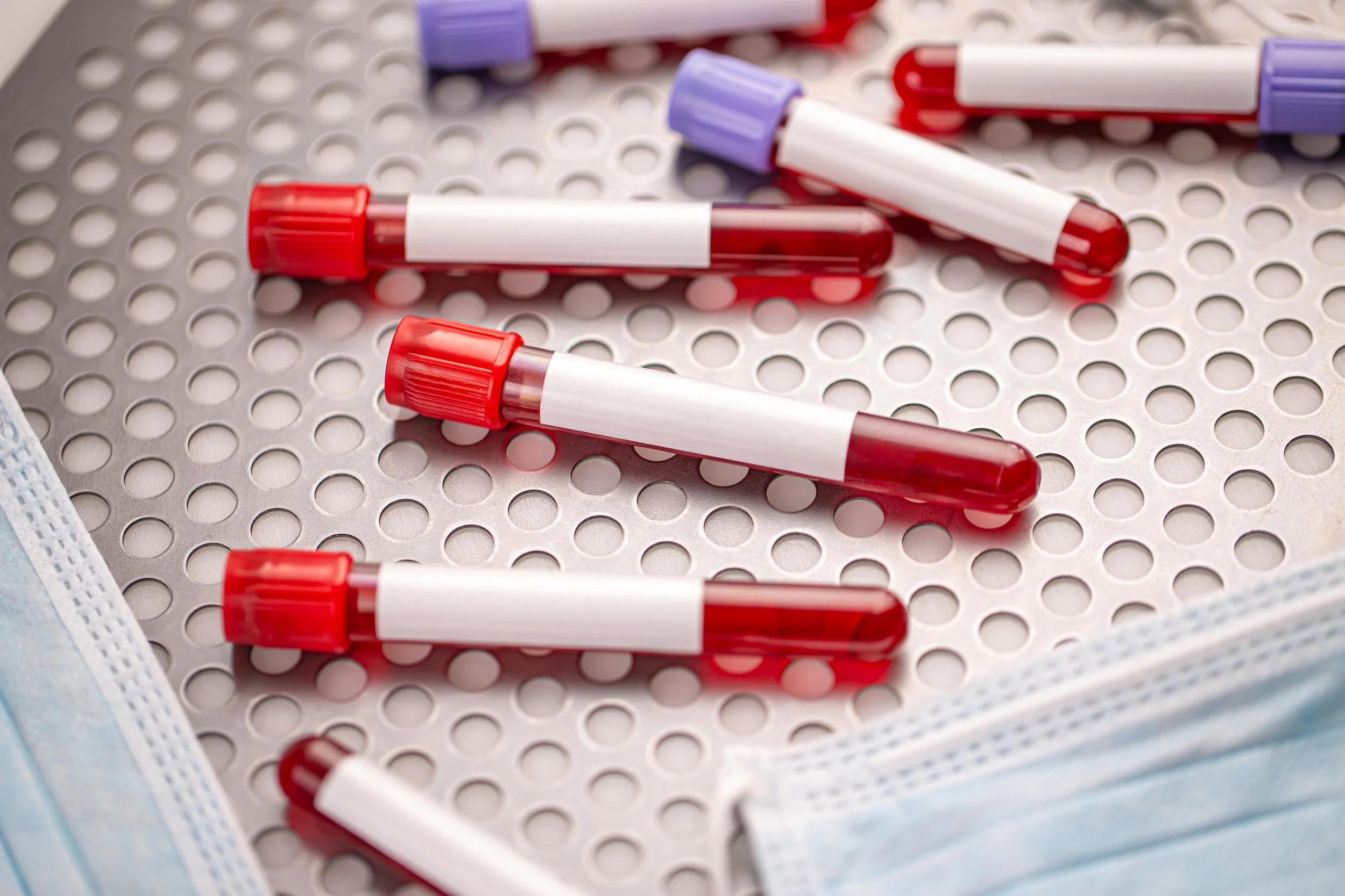 SDMA Is Moving Into Routine Chemistry Panels. Here Is What the Clinical Data Actually Says.
