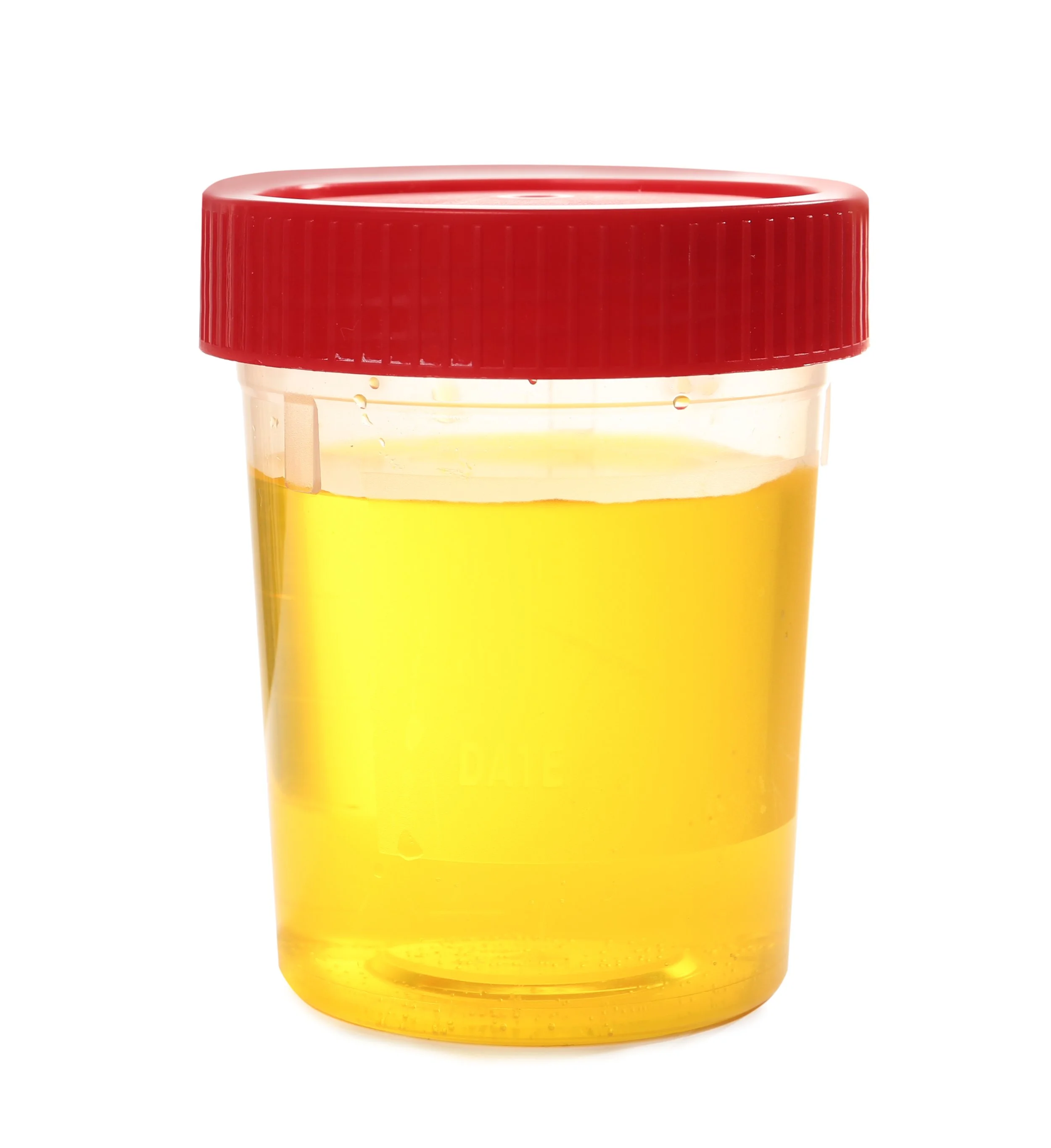 A Simple Urine Ratio Could Help Predict Which CKD Dogs Are Running Out of Time