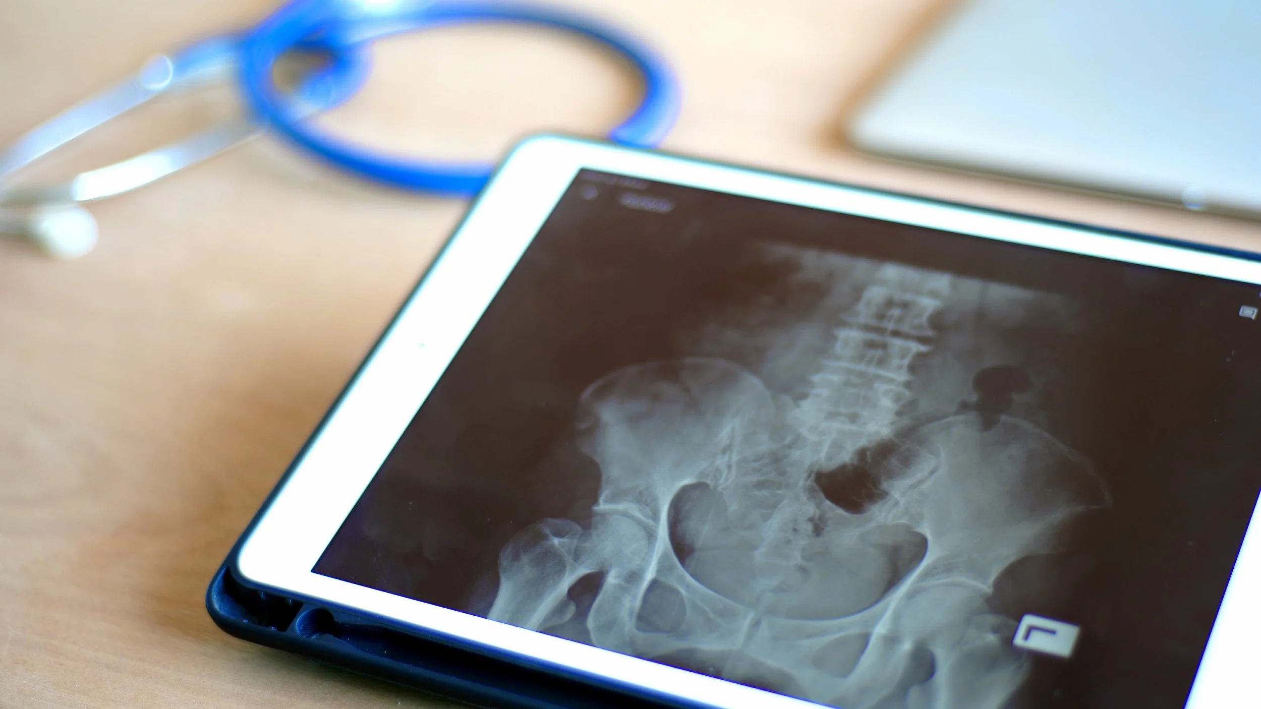 Tufts Veterinarians Just Joined a $15 Million Push to Finally Beat Osteosarcoma. Dogs Are Central to Why It Could Work.
