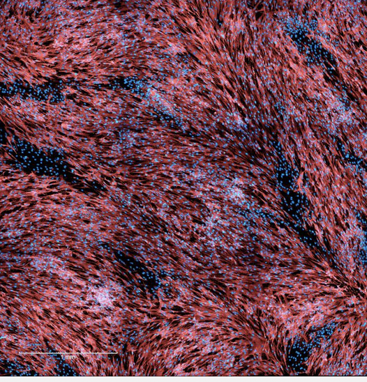 Researchers Identify a Biological Factor That May Help Mpox Spread