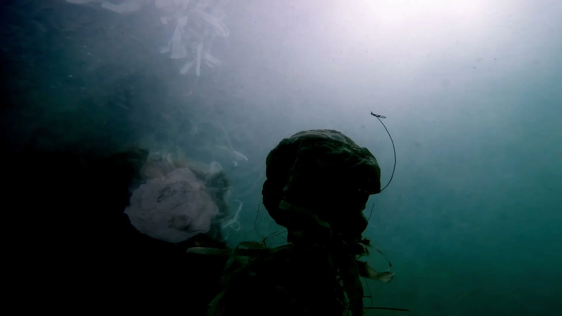 Teratoma Placement - frame at 0m23s.jpg