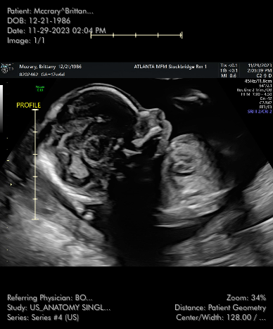 Life of Latnie gallery image 4