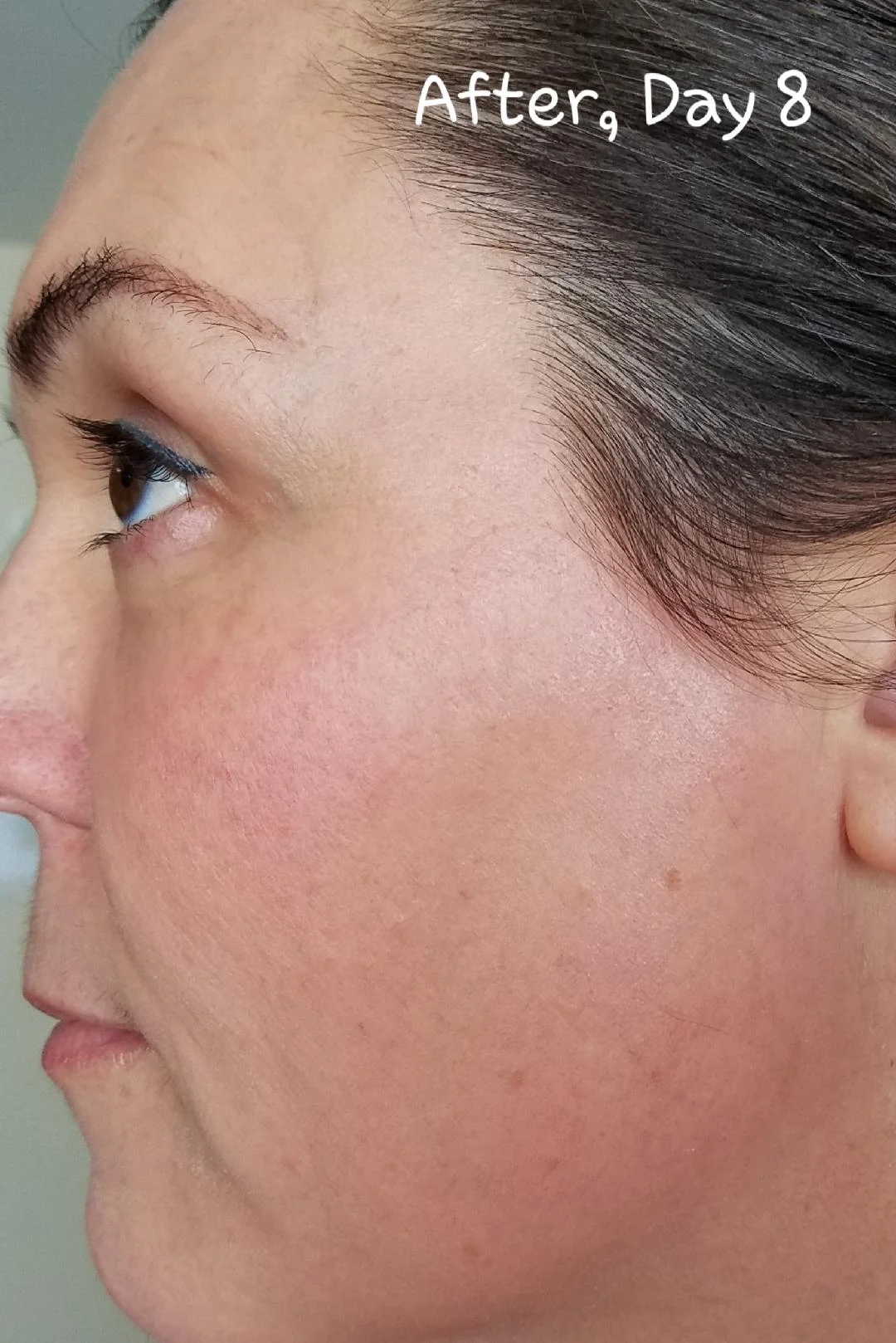 Elaine Brennan Skin Renewal Day 8