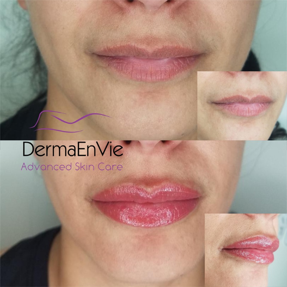 lips.jpg