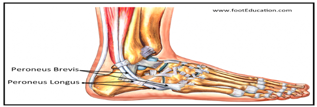 Although you may or may not remember any specific injury, you have  developed pain on the outside of your ankle and/or foot that is getting  worse and limiting your ability to do
