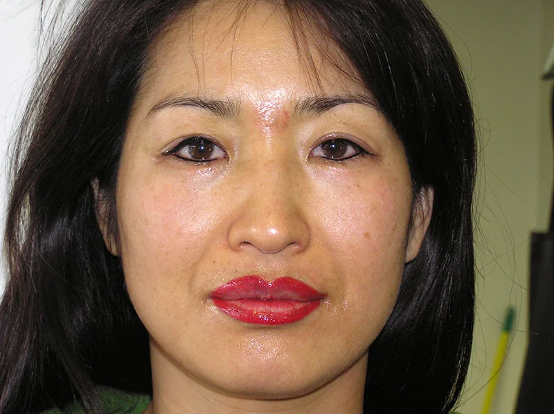 Immediately after lip blend.