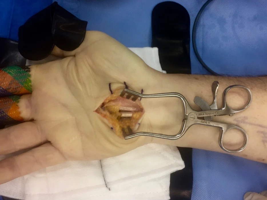 Hand Surgery Photo.jpg
