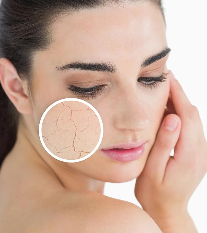 4 Of The Best Products For Dry Skin