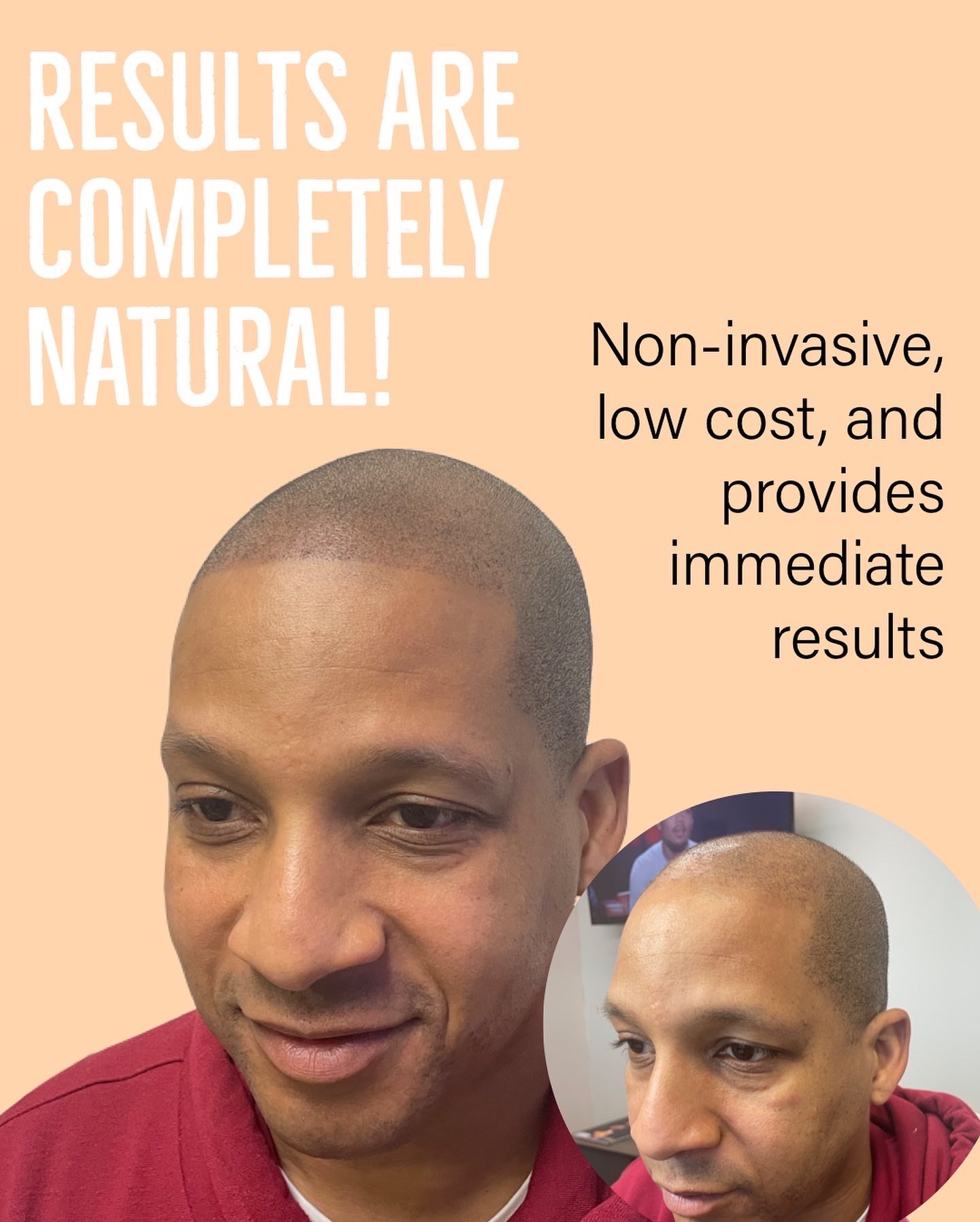 Hair loss colorado springs.JPG