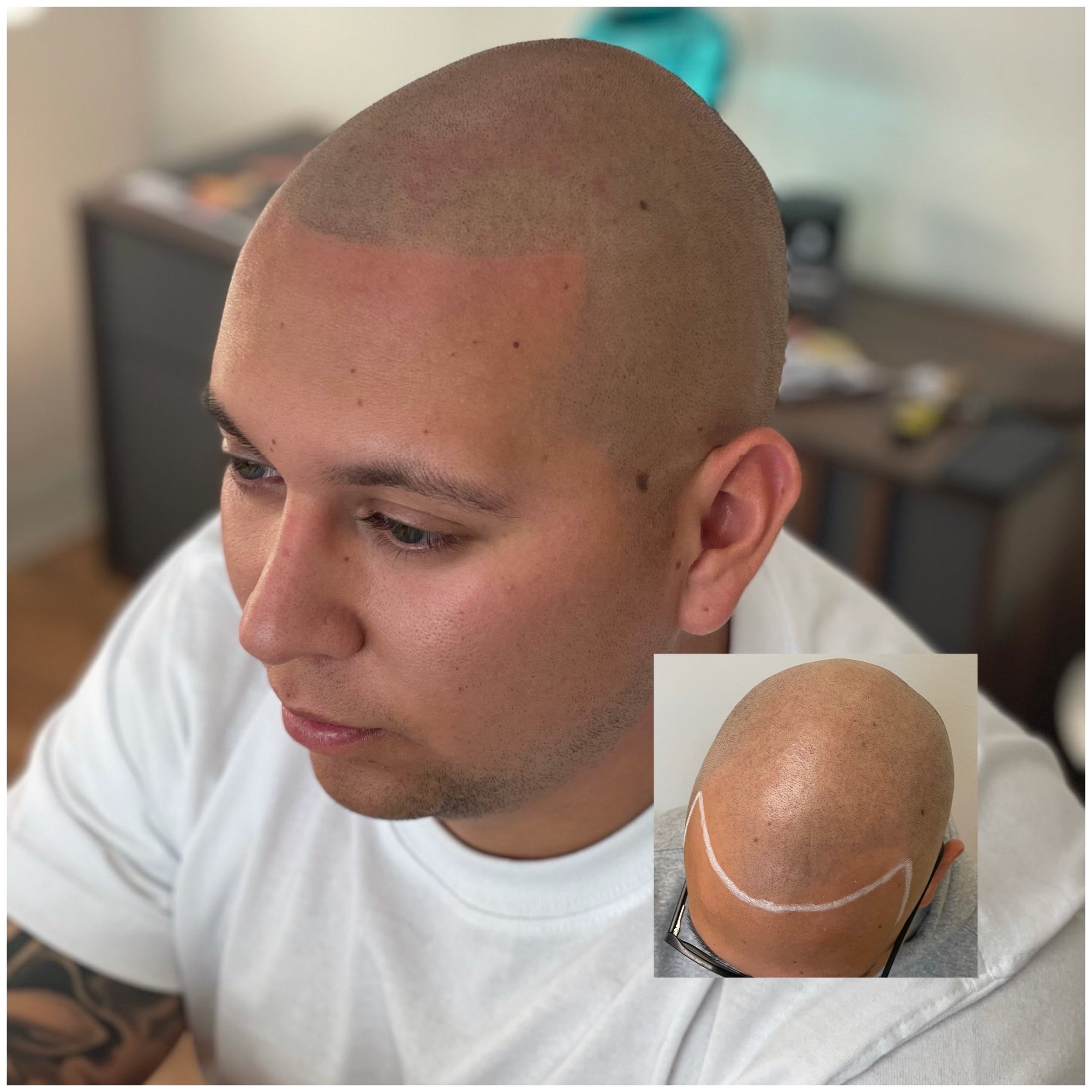 Hair Tatto For Receding Hairline