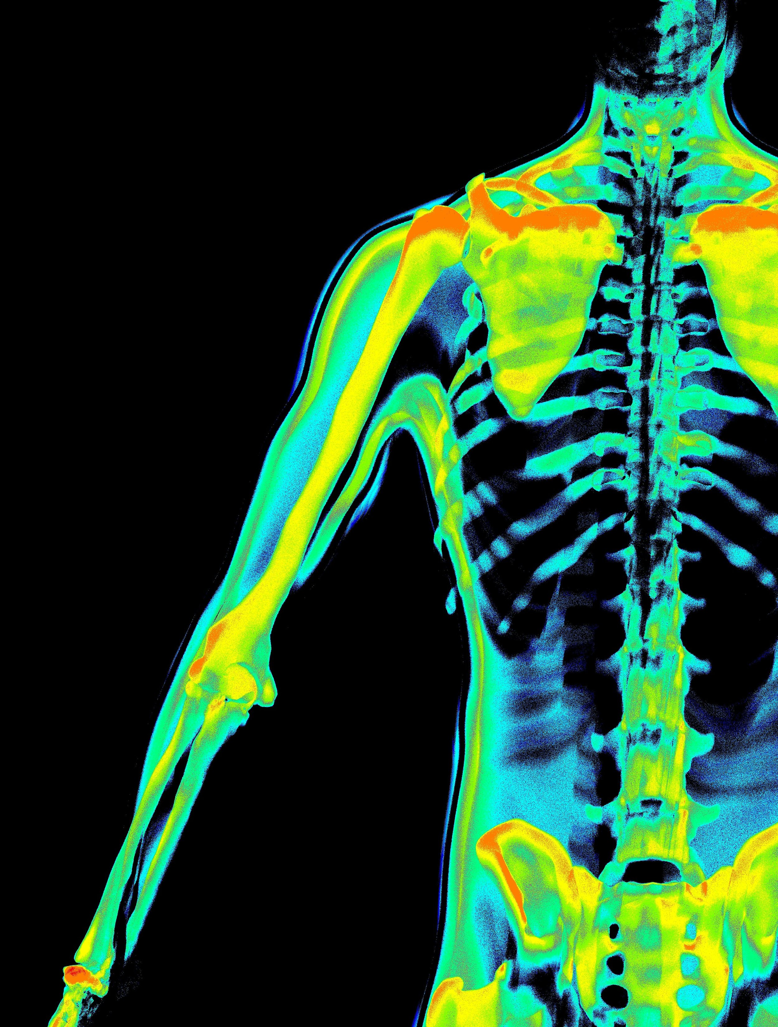SomaYoga Therapy for Strong Bones