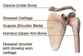 shoulder3.jpg