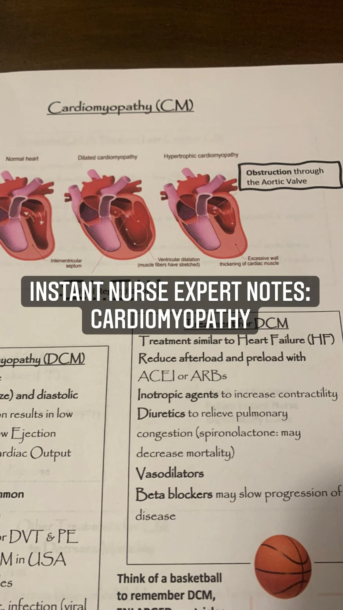 Instant Nurse Expert Notes: Cardiomyopathy