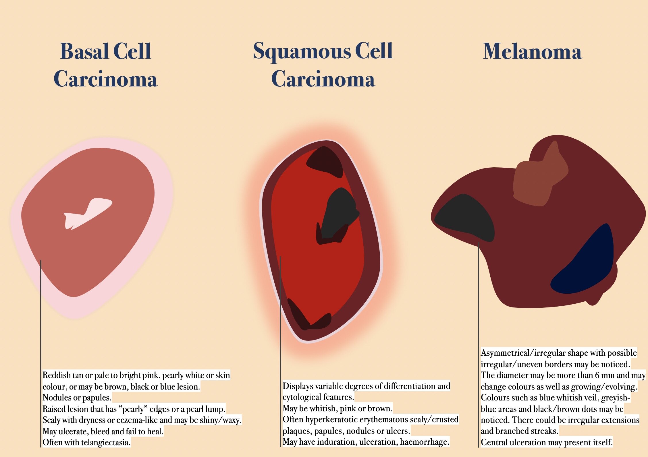 Main Types Of Skin Cancer