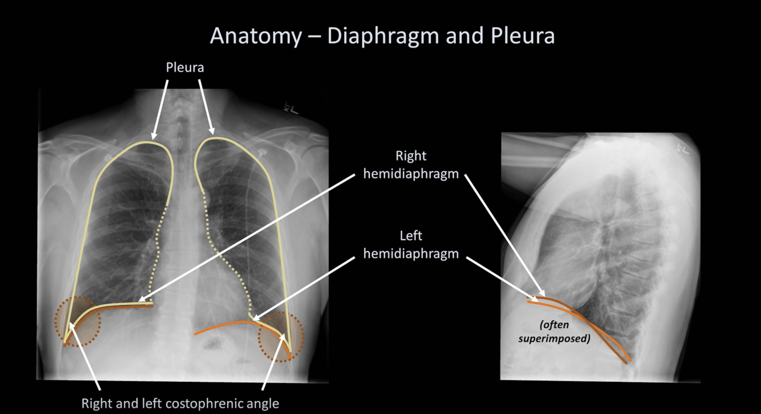 Chest XRay For Students How to Interpret and Present Methodically