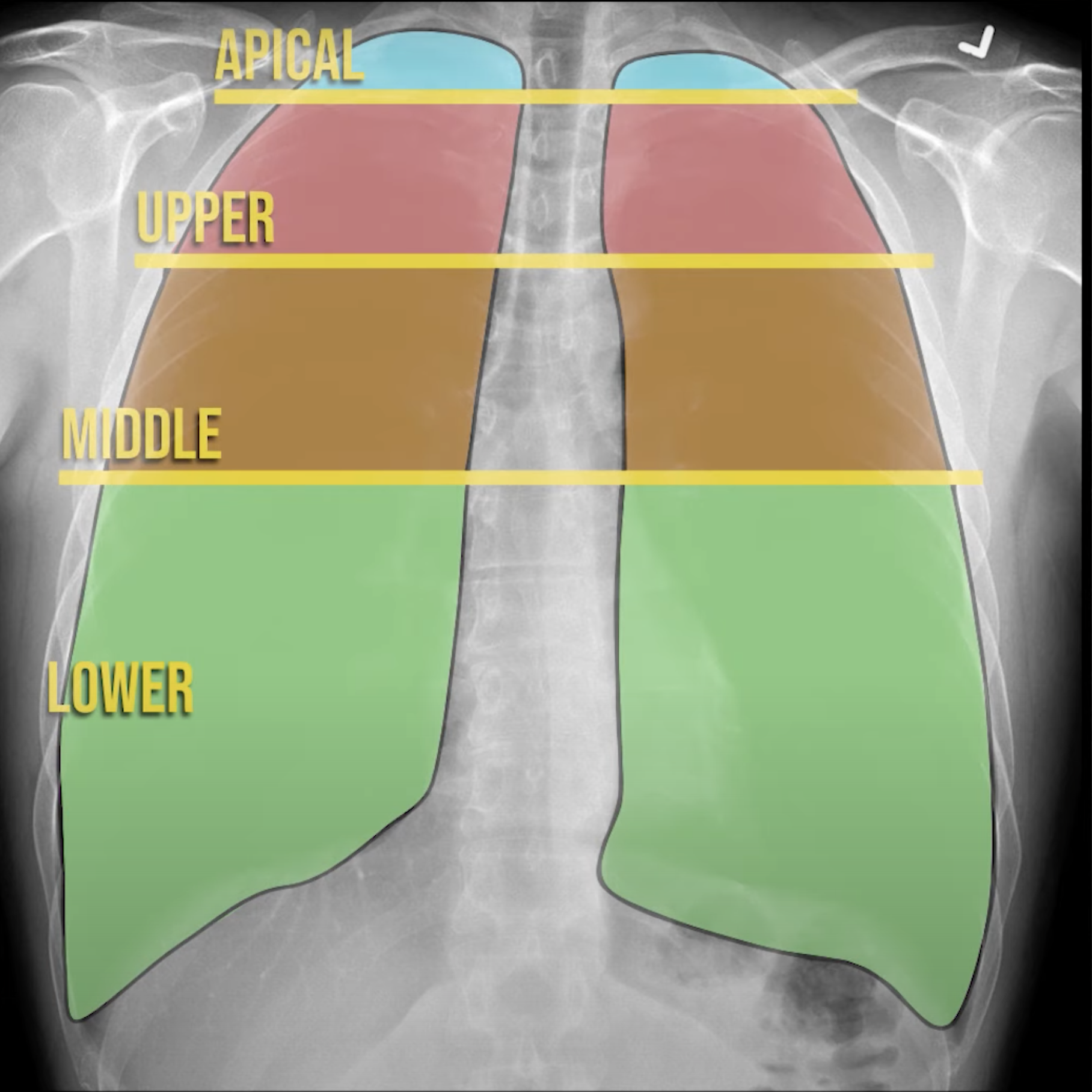 Chest XRay For Students How to Interpret and Present Methodically