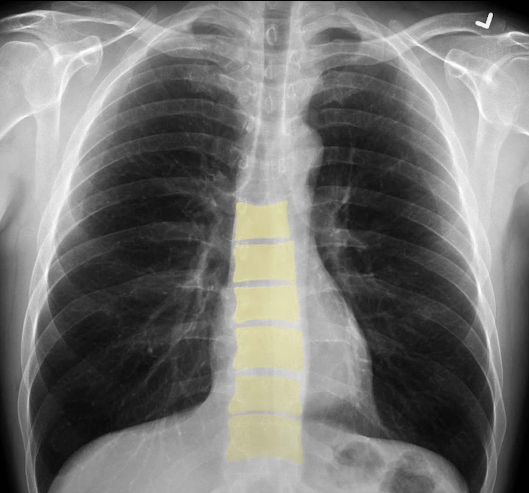 chest x ray case study