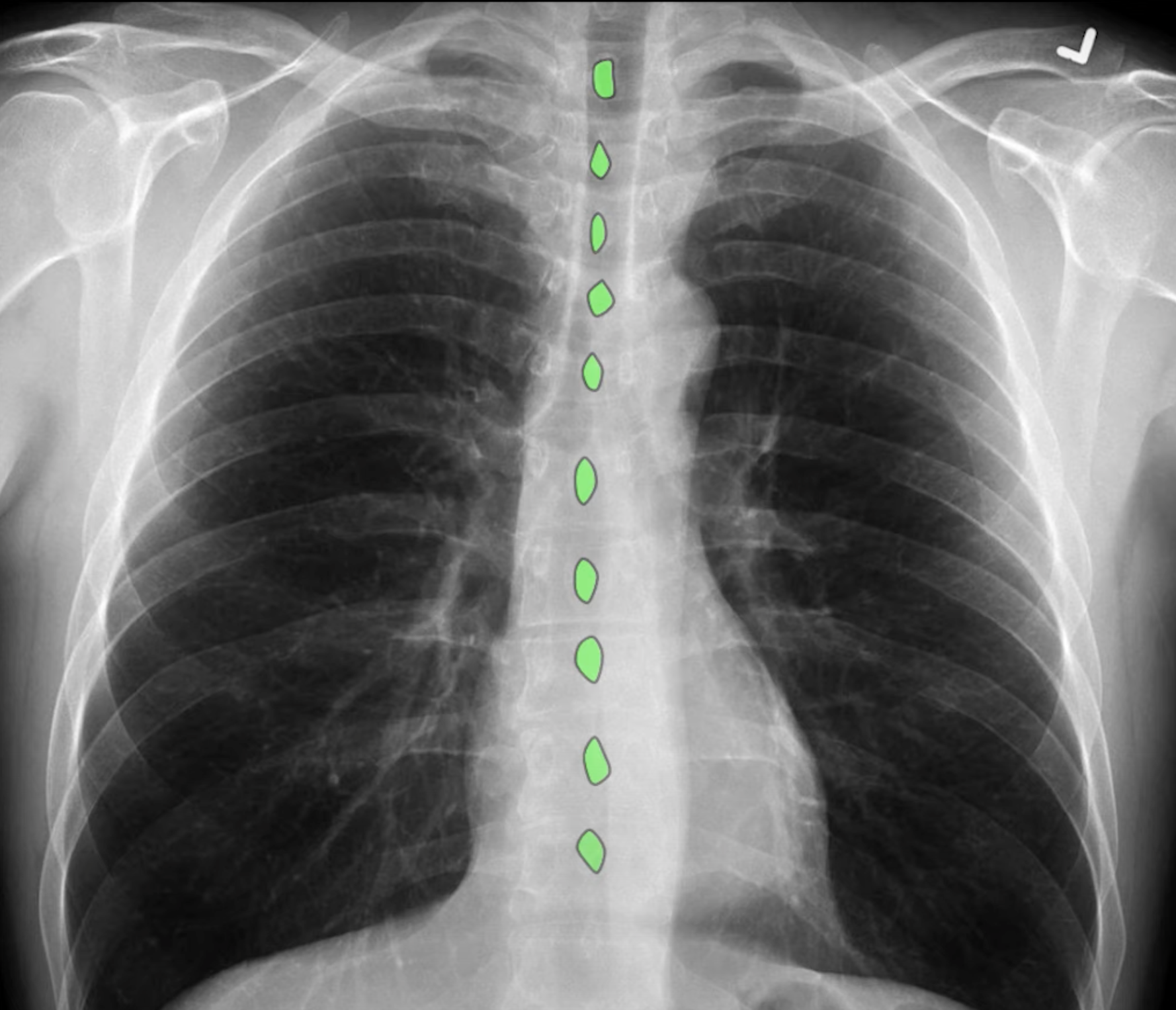 how much is a chest xray for a dog