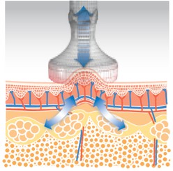 a2tc_Vacuum-Suction.png