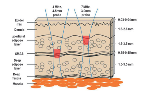 Cartridge Depth