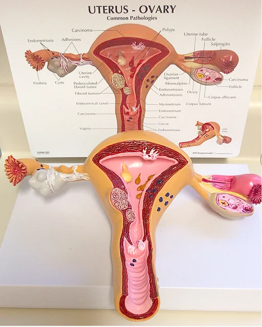 IVF