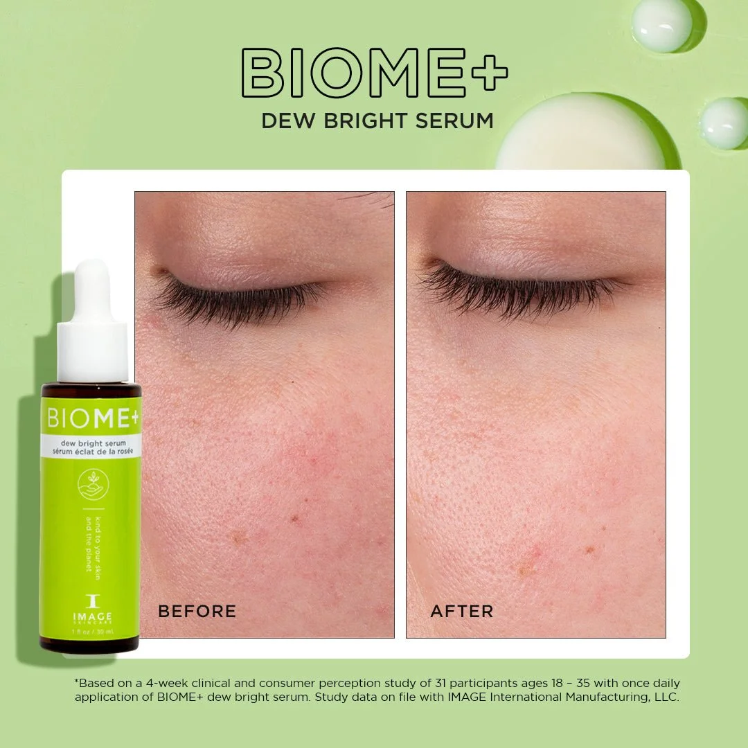 BIOME_-DEW-BRIGHT-SERUM-PDP-R08_1080x.jpg