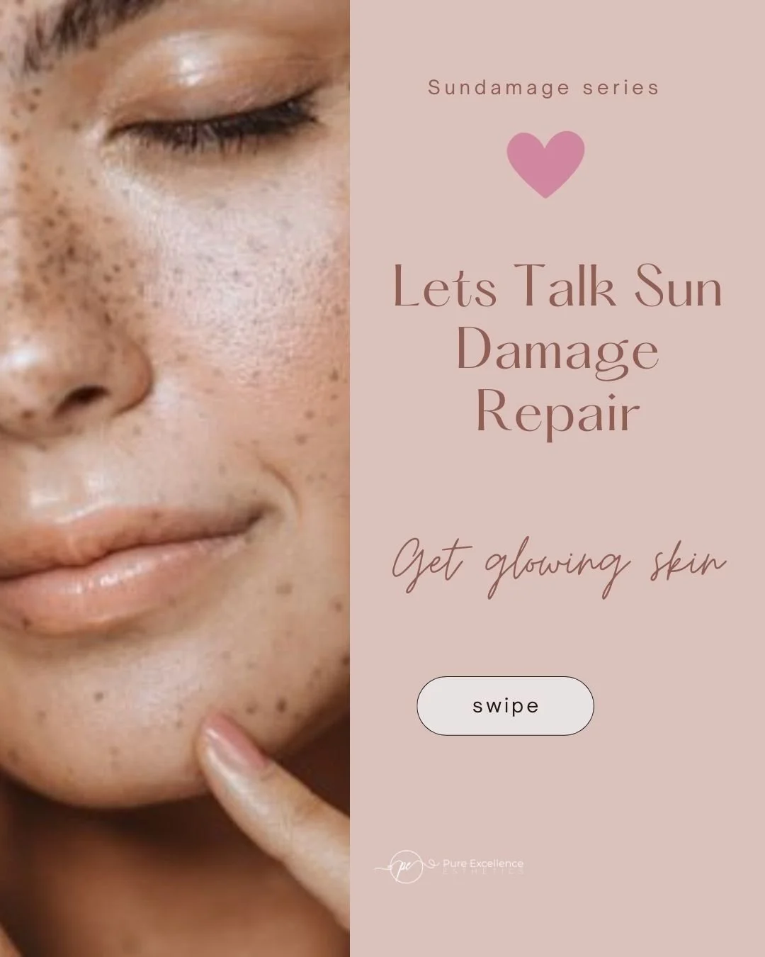 ☀️ Summer fun can leave its mark&hellip; and we&rsquo;re not talking about the memories. 🌊 Between UV rays, heat, and long days outdoors, your skin may be feeling the after-effects: dryness, dark spots, fine lines, and dullness.

But the good news? 