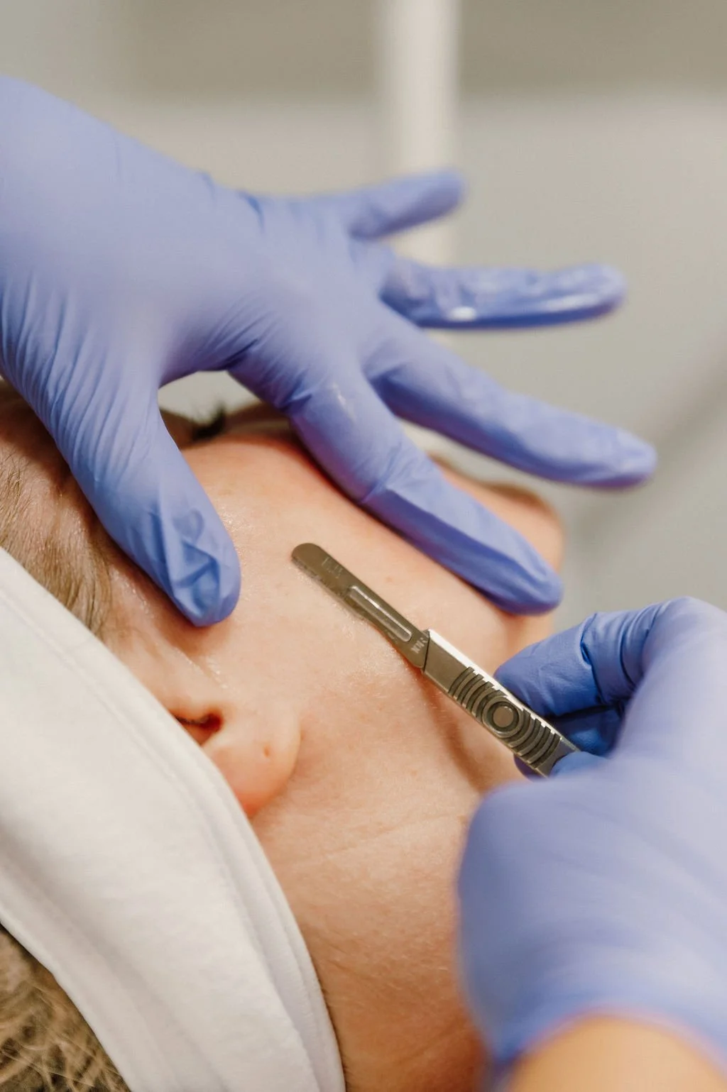 How Dermaplaning Is the Game Changer Your Skin Needs