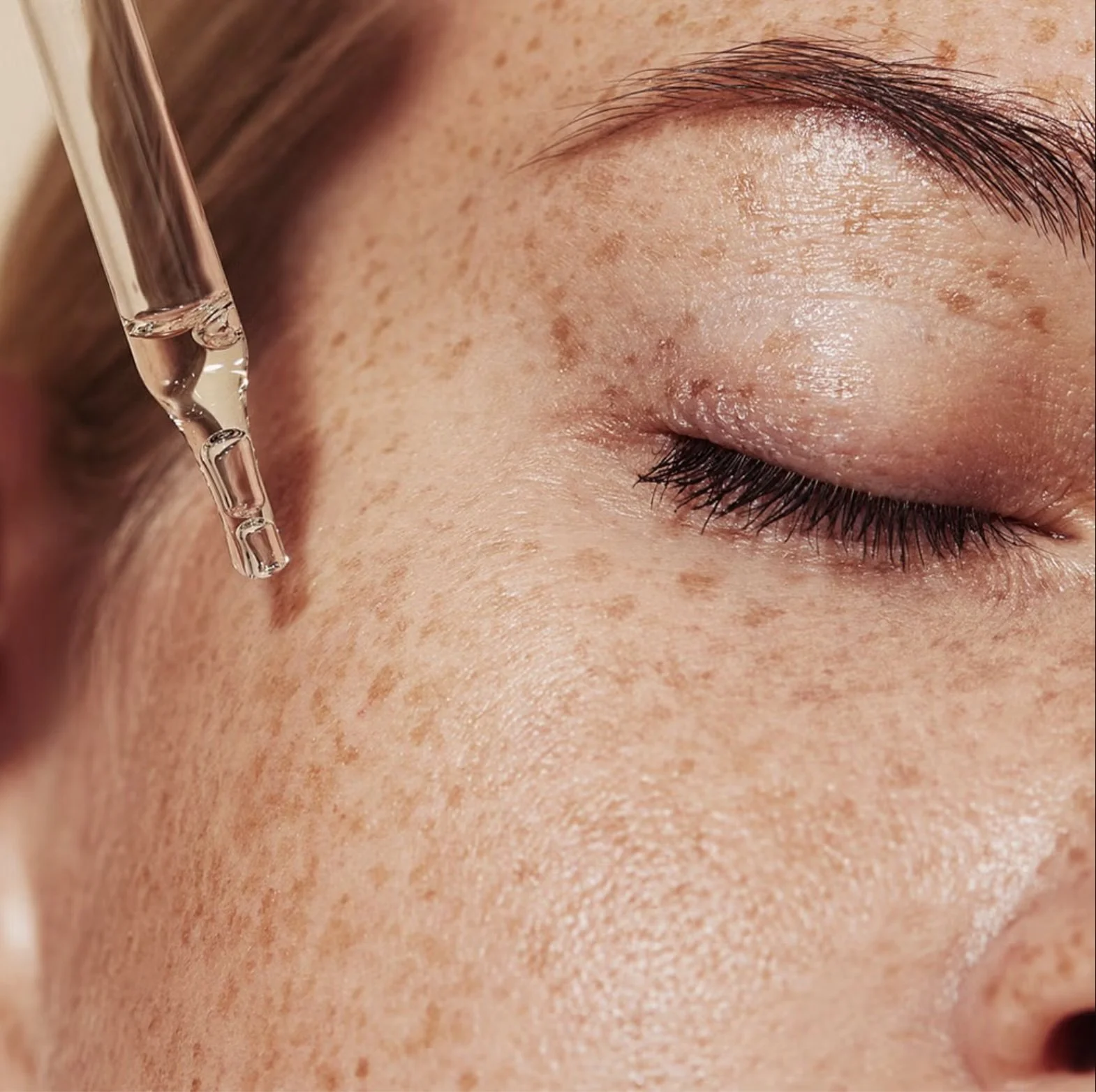 The Ultimate Guide to Hyperpigmentation Treatments: How to Get Brighter, More Even-Looking Skin