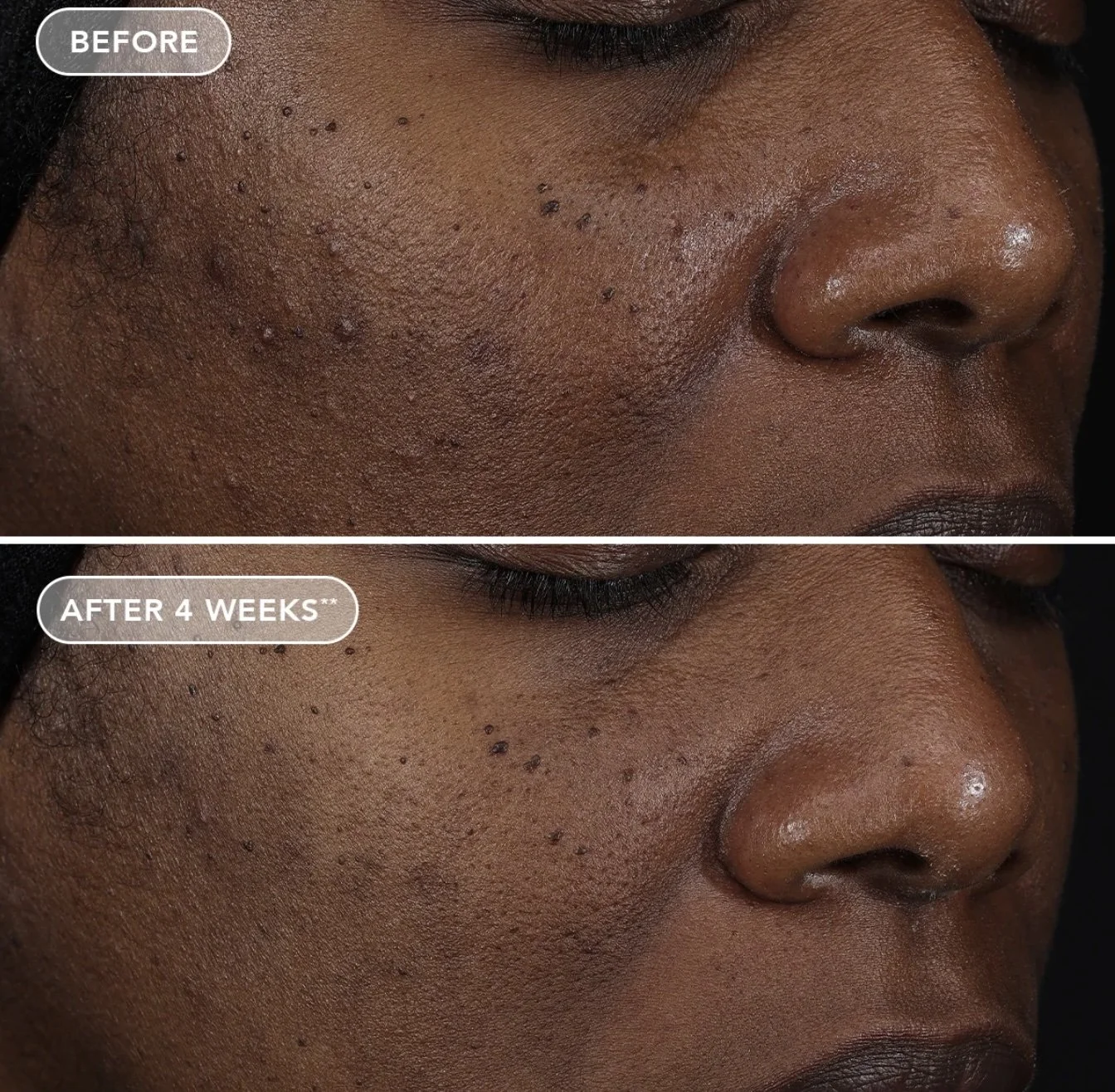 retinol.3.1.jpg