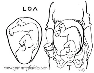 Optimal Fetal Positioning North Shore Doula