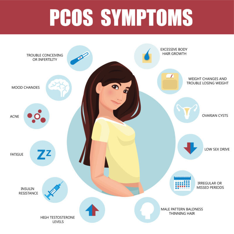 POLYCYSTIC OVARIAN SYNDROME (PCOS Can Cause Hair Loss NYC New York NY