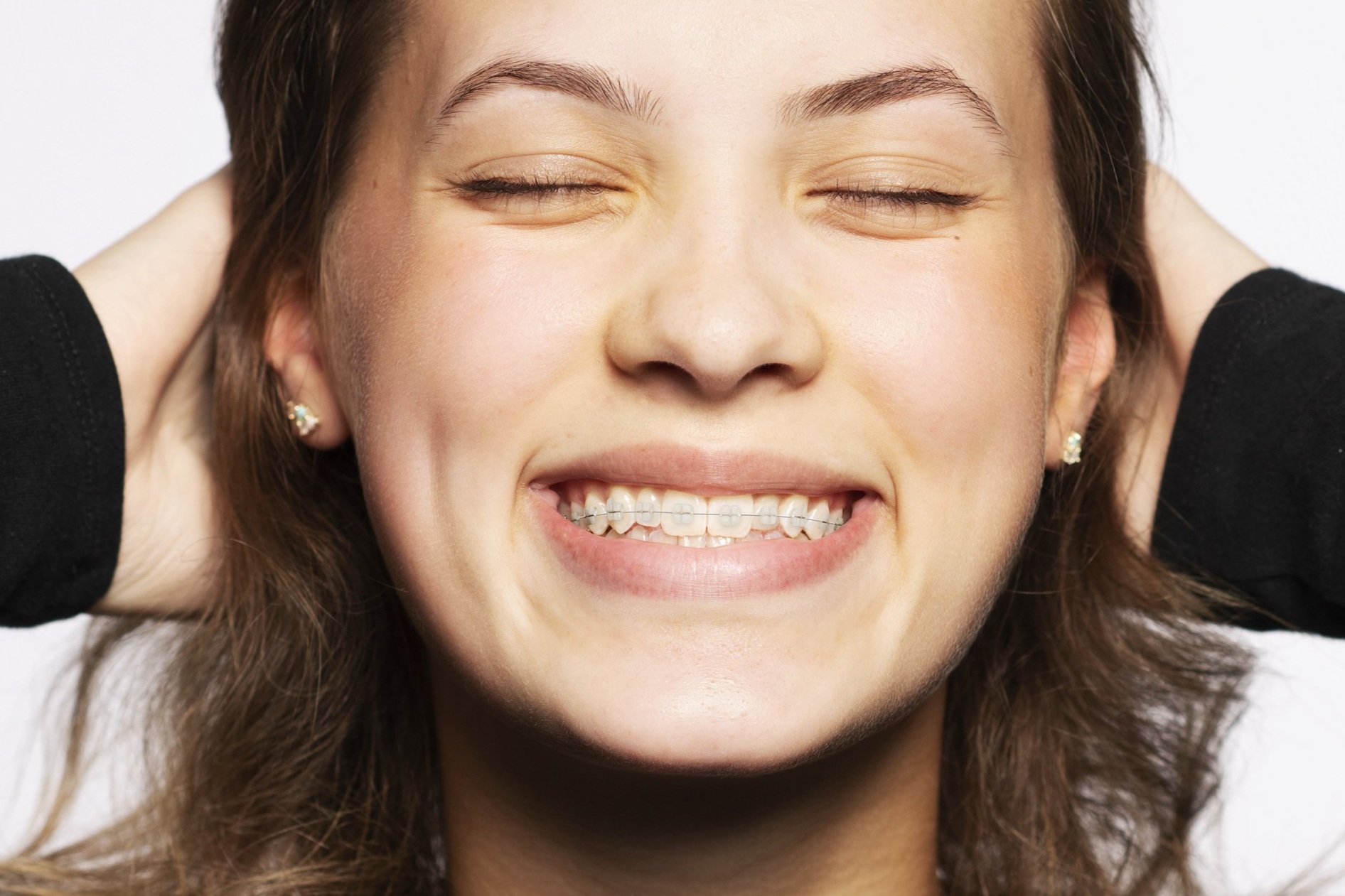   Your smile is unique.   Your braces should be too!      Learn about LightForce   