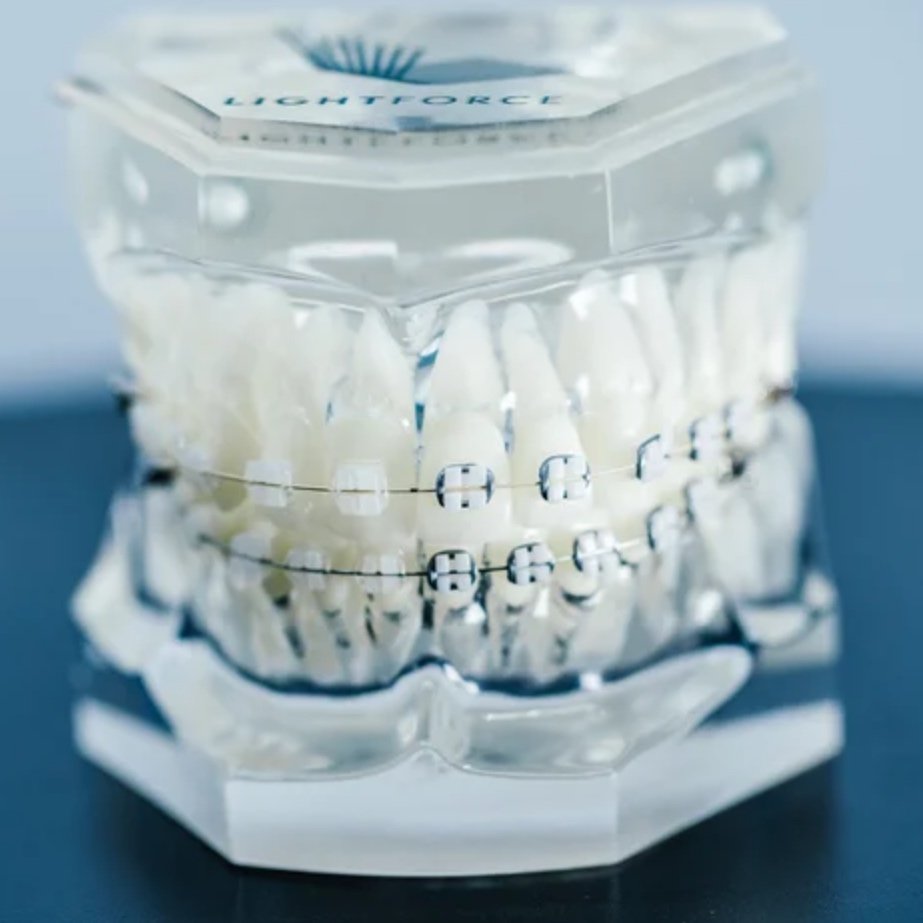 Types of Treatment Available — NORTH COUNTY ORTHODONTICS