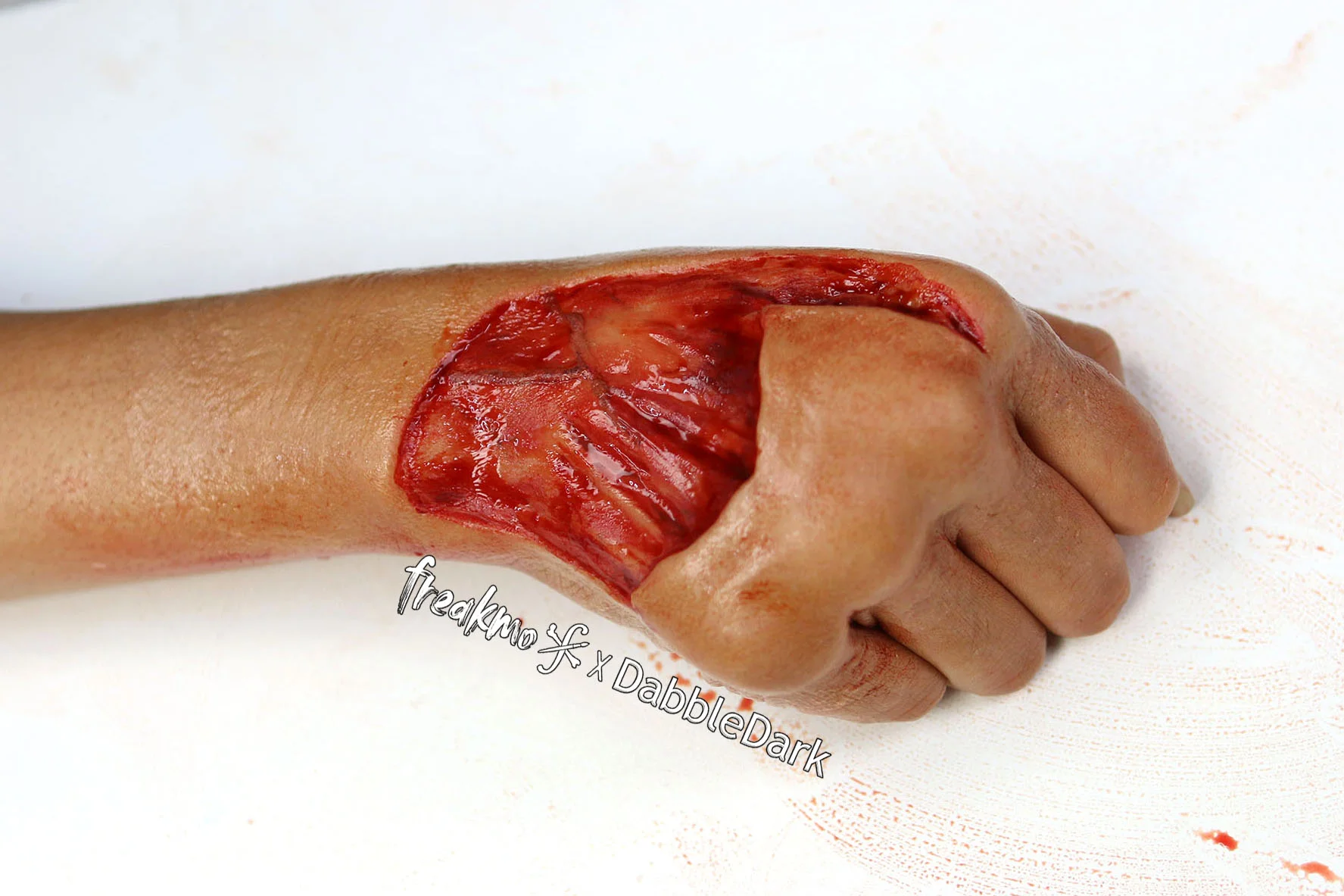 hand wound .jpg