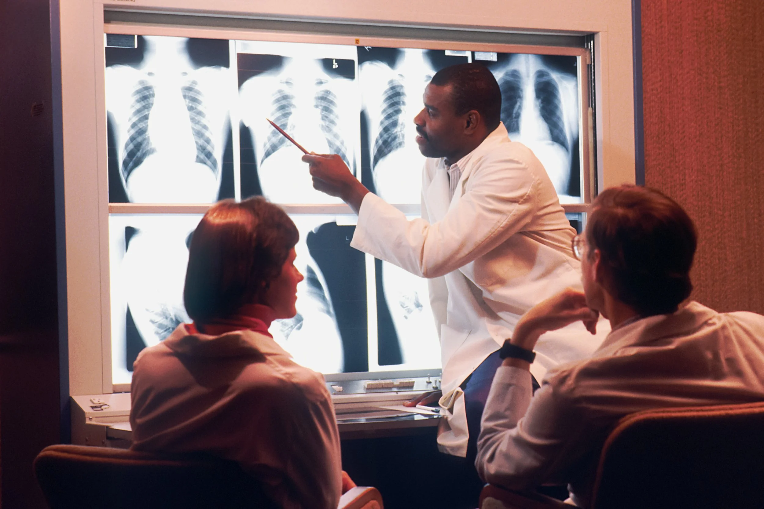 AI can estimate heart attack and stroke risk from a single X-ray