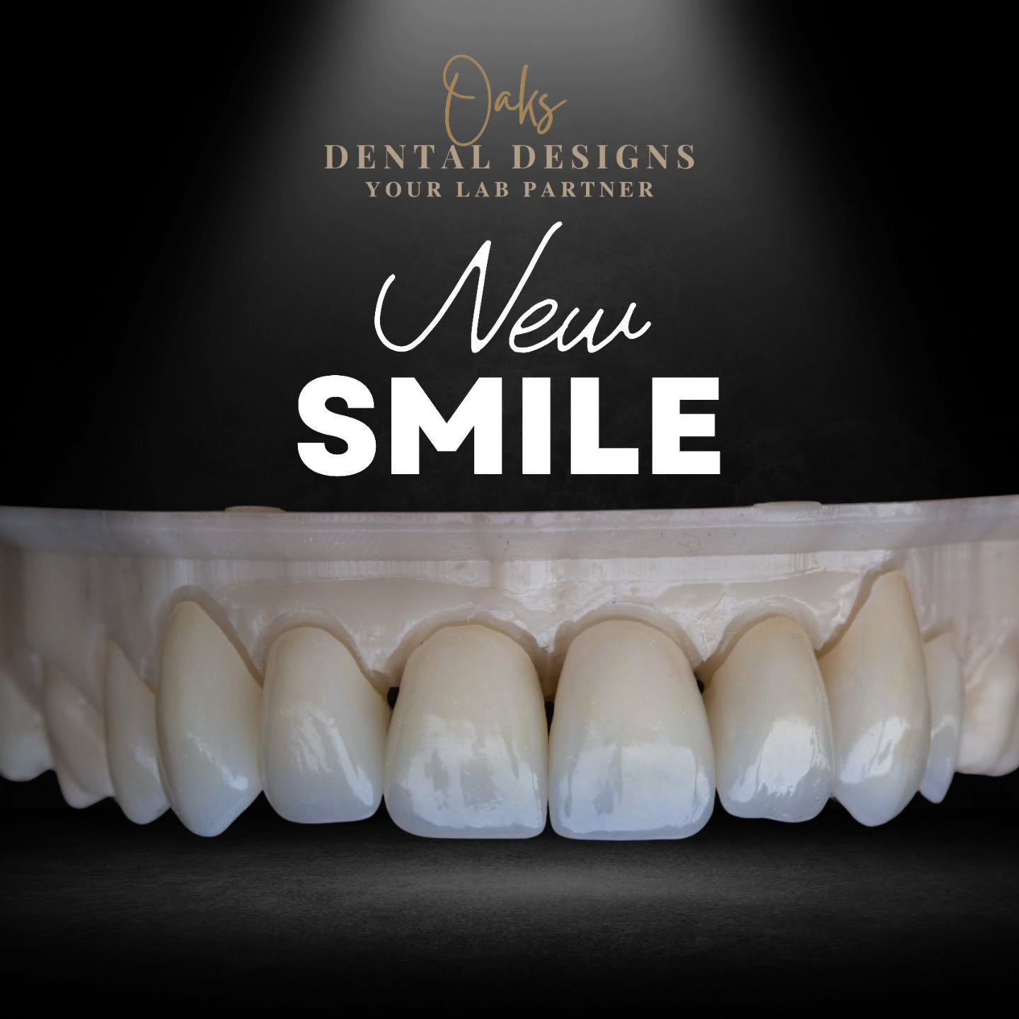 Simply beautiful!  Ivoclar zirconia and ivocolor stains for the win here! 
ColLABorating with Dr. Jason Ford is an absolute dream.  He does wonderful work, collects excellent data for us to treatment plan with, and then takes the most thorough case p
