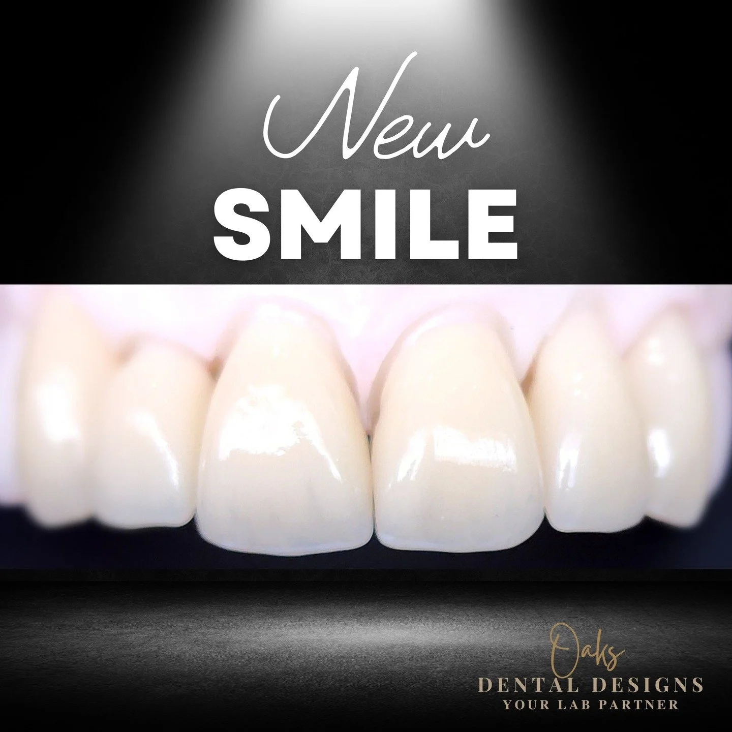 Another new smile is heading out to help build confidence for the client who will be smiling bright soon. We don't ever tire from creating these smiles. We believe a smile you love allows one to express who they are. 

#newsmile #smilemakeover #smile