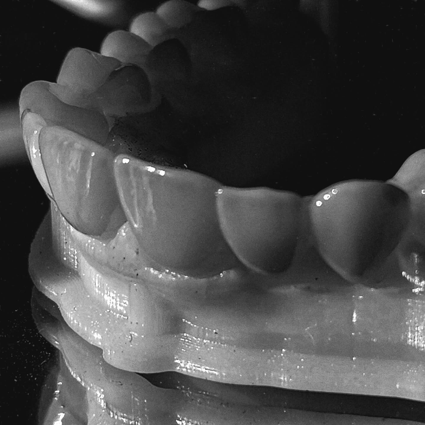 Teeth are not always just flat surfaces....
That's all.

#dental #mommieswhomill #teeth #newsmile #dentisty