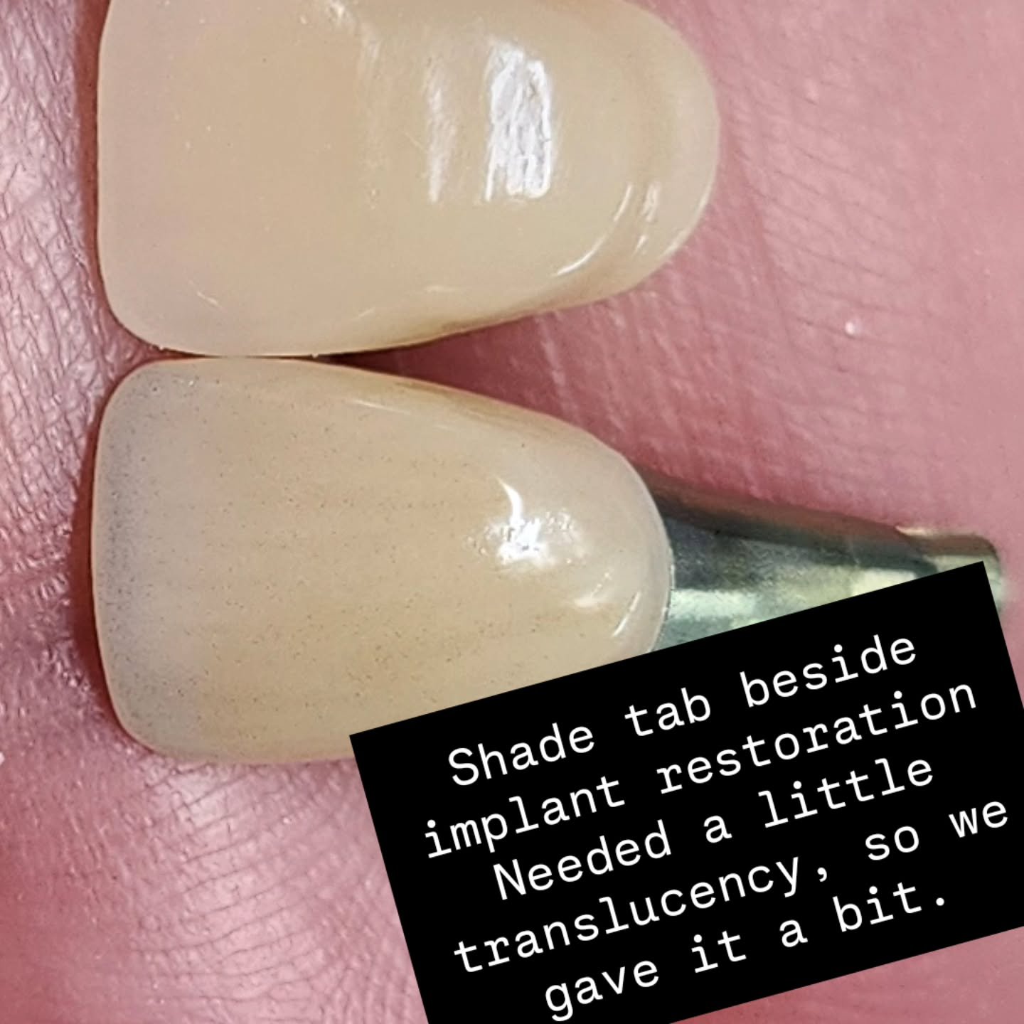 Your doctor chooses the base shade to match. They send us photos, and then we add all the little characterization that is needed for the tooth to disappear once it is delivered. 

We love getting photos or having patients come by for custom shade che