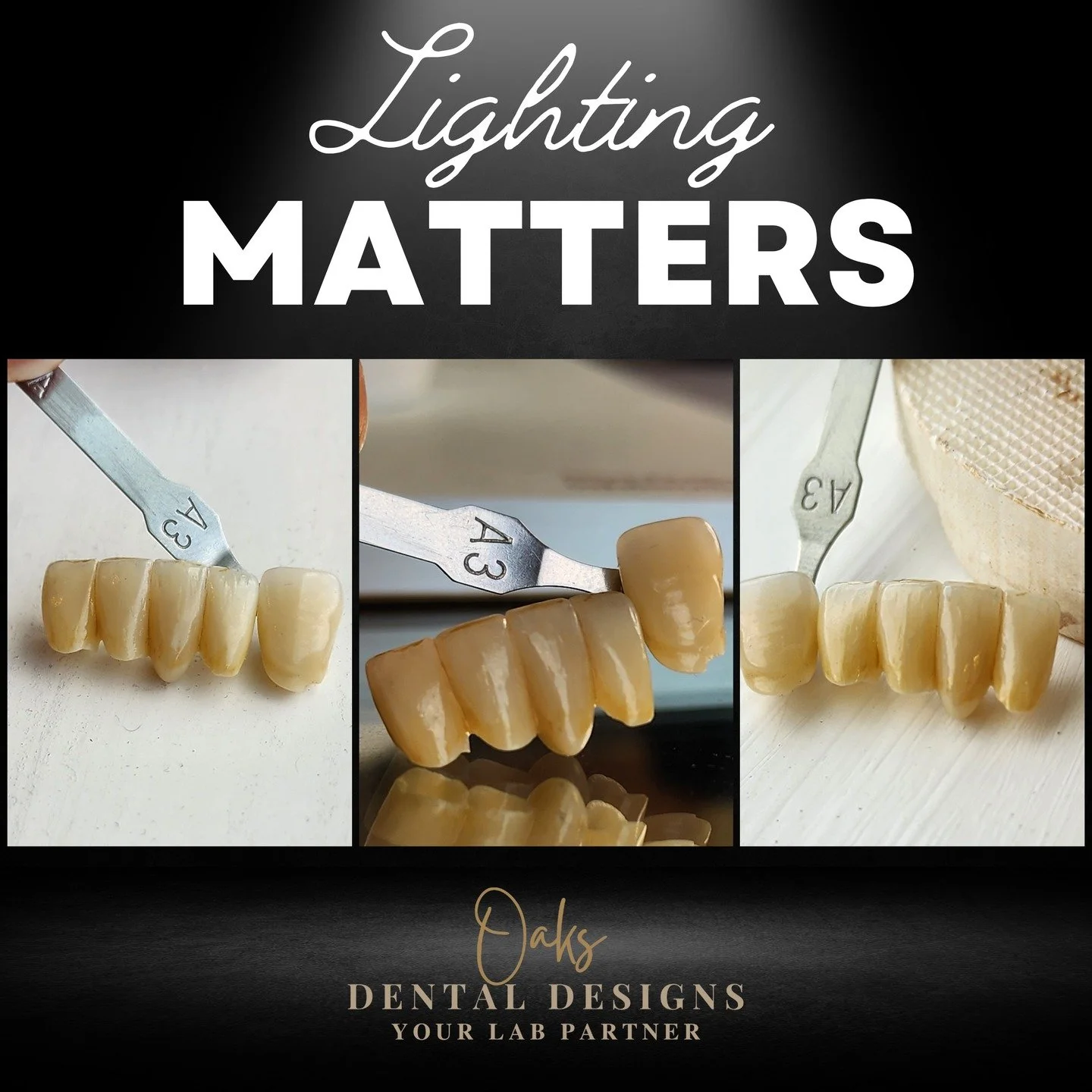 Same characterized anterior bridge, same shade tab, different lighting and angles. Different lighting gives us different details when we are receiving photos from doctors and their teams. Taking pictures of this bridge before it went out seemed to re