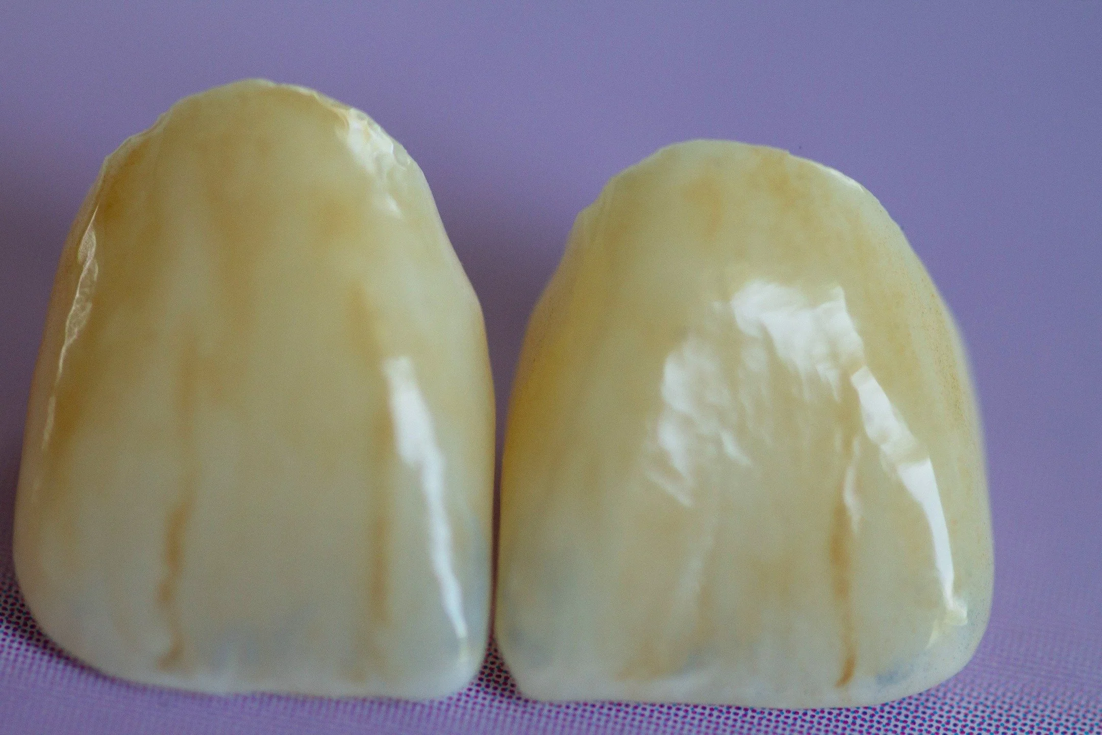 Another mini smile makeover. 
Getting the the pictures from our offices is CRUCIAL! Most all our clients are not anywhere close to us, so our colLABoration on photos and communication is a must have. We are looking forward to seeing these seated!

#d