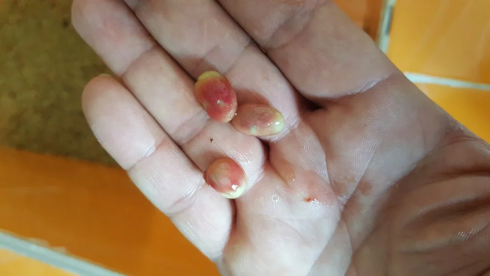Sugar “clumps” in pink on the honey/pectin layer surrounding the coffee bean.