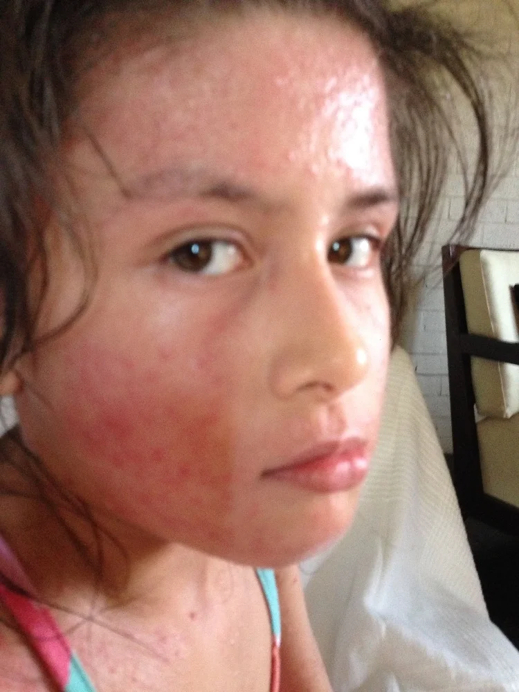 Nayeli's story