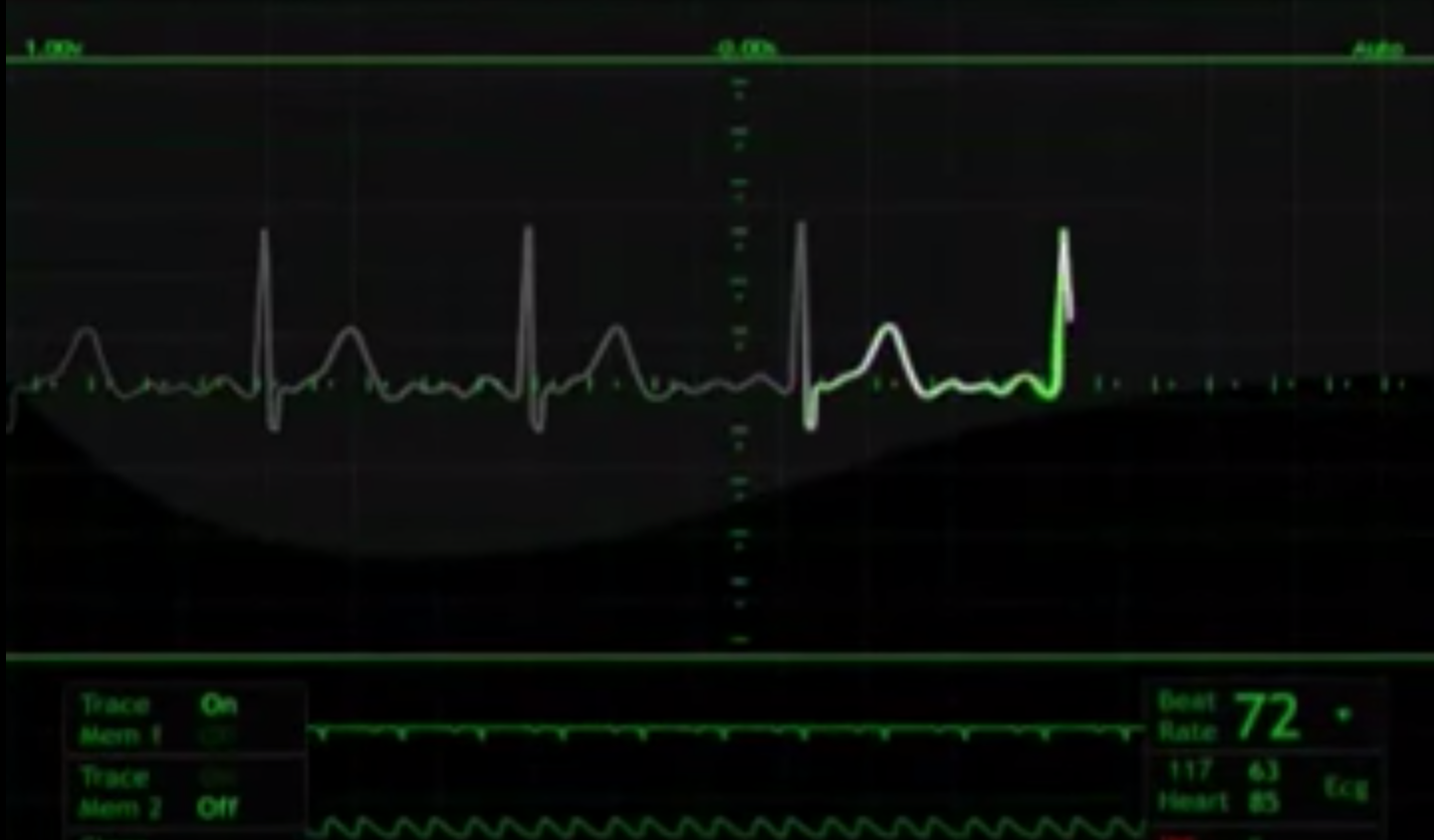 Screen Shot 2019-01-26 at 4.24.30 pm.png